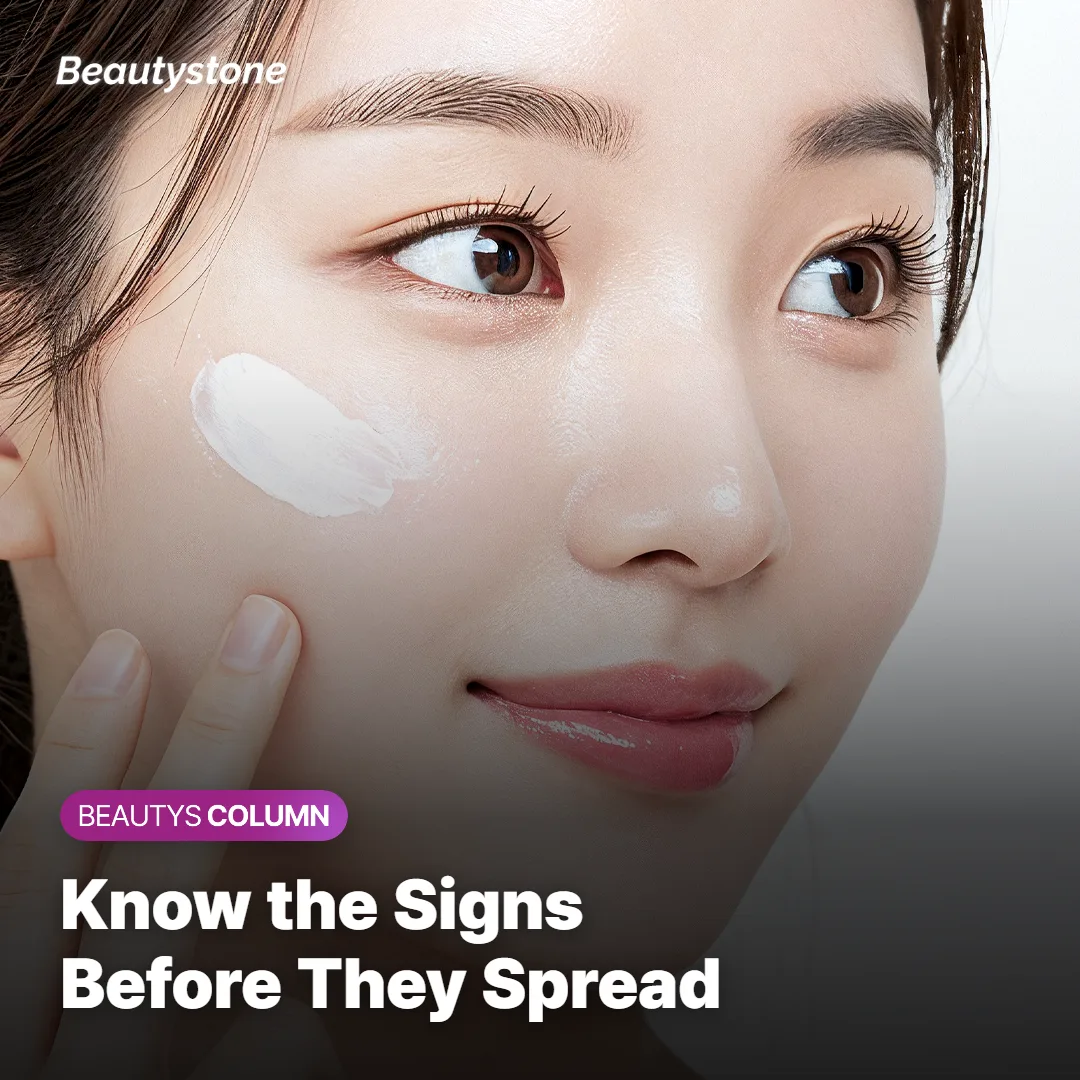 Photo representing skin recovery after a laser side effect