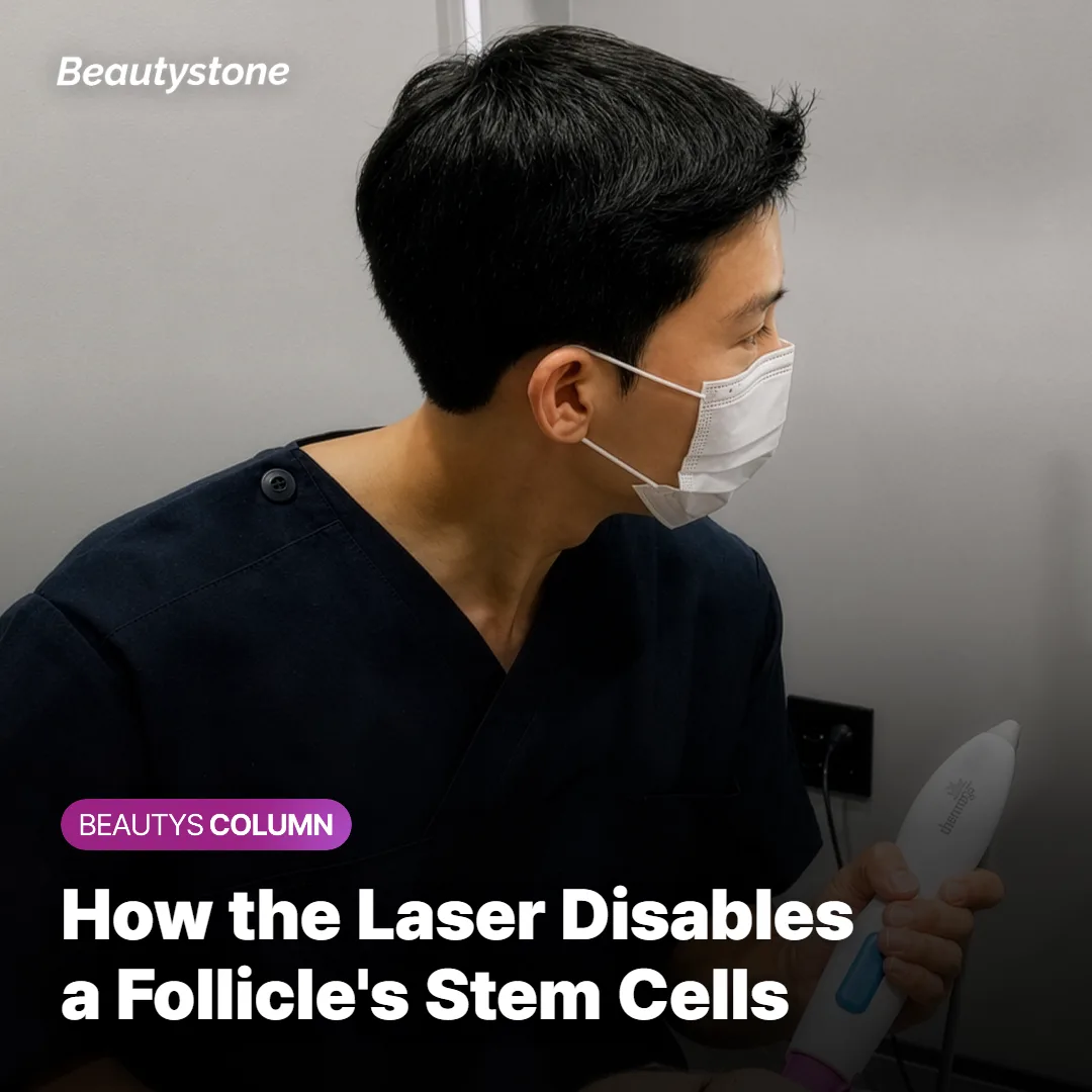 Cross-section diagram of skin showing how laser energy reaches the hair follicle bulge
