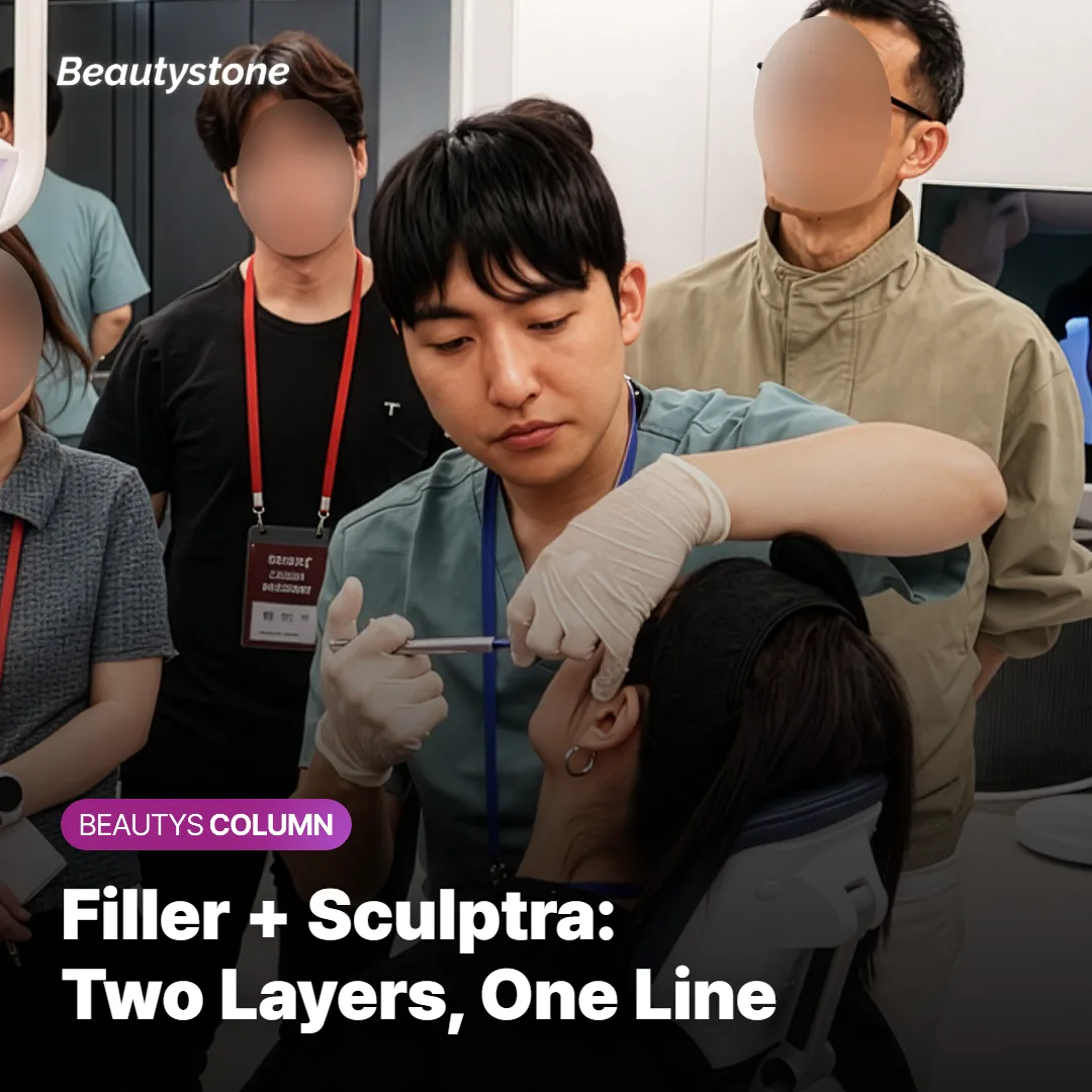 Timeline graphic showing hip filler and Sculptra combined results from day one through month four