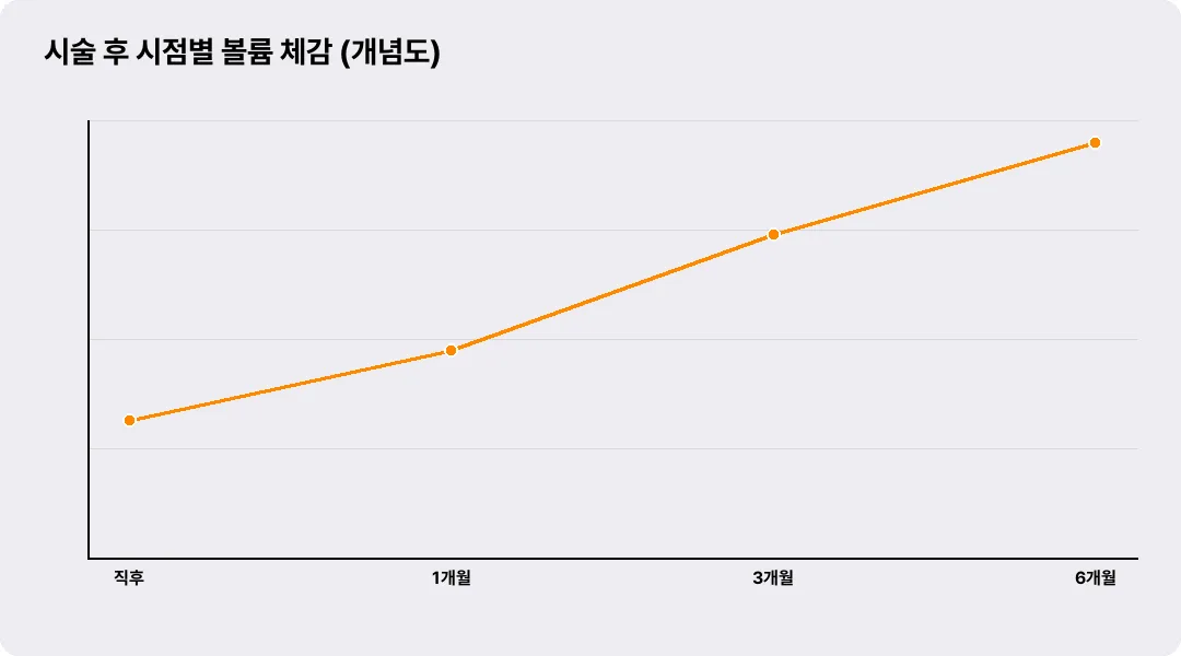 시술 후 시점별 볼륨 체감 (개념도)