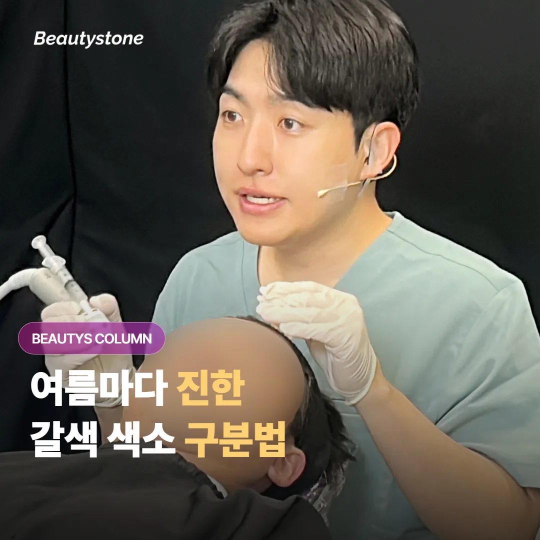 여름만 되면 얼굴에 올라오는 갈색 색소, 기미와 주근깨와 잡티는 서로 어떻게 다를까요?