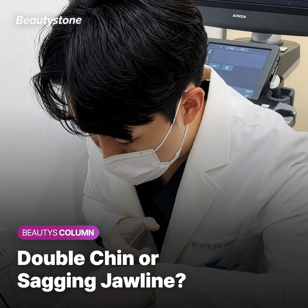 Illustration comparing double chin fullness and jawline sagging as two different concerns