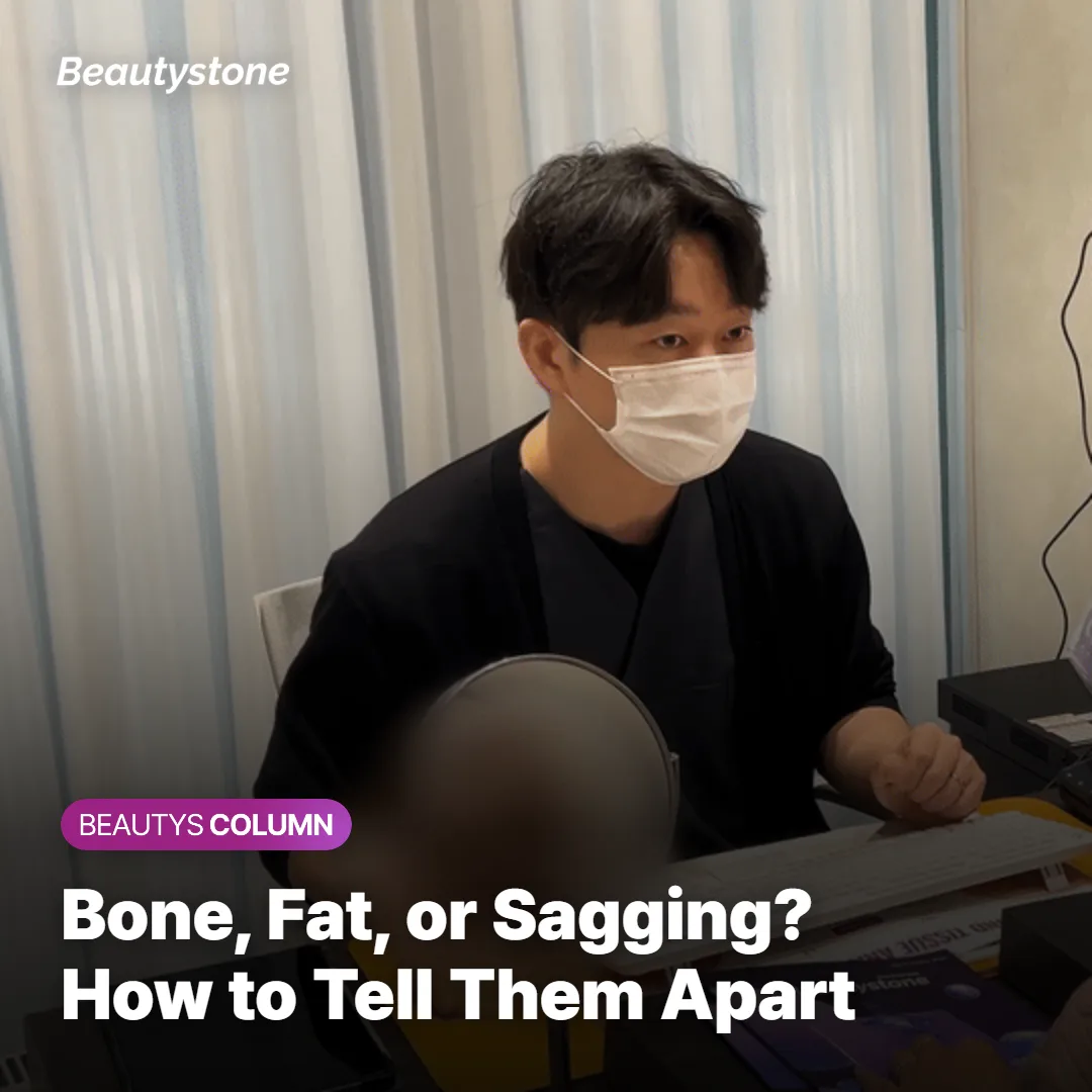 Diagram-style comparison of bone, soft tissue, and sagging layers behind cheekbone prominence