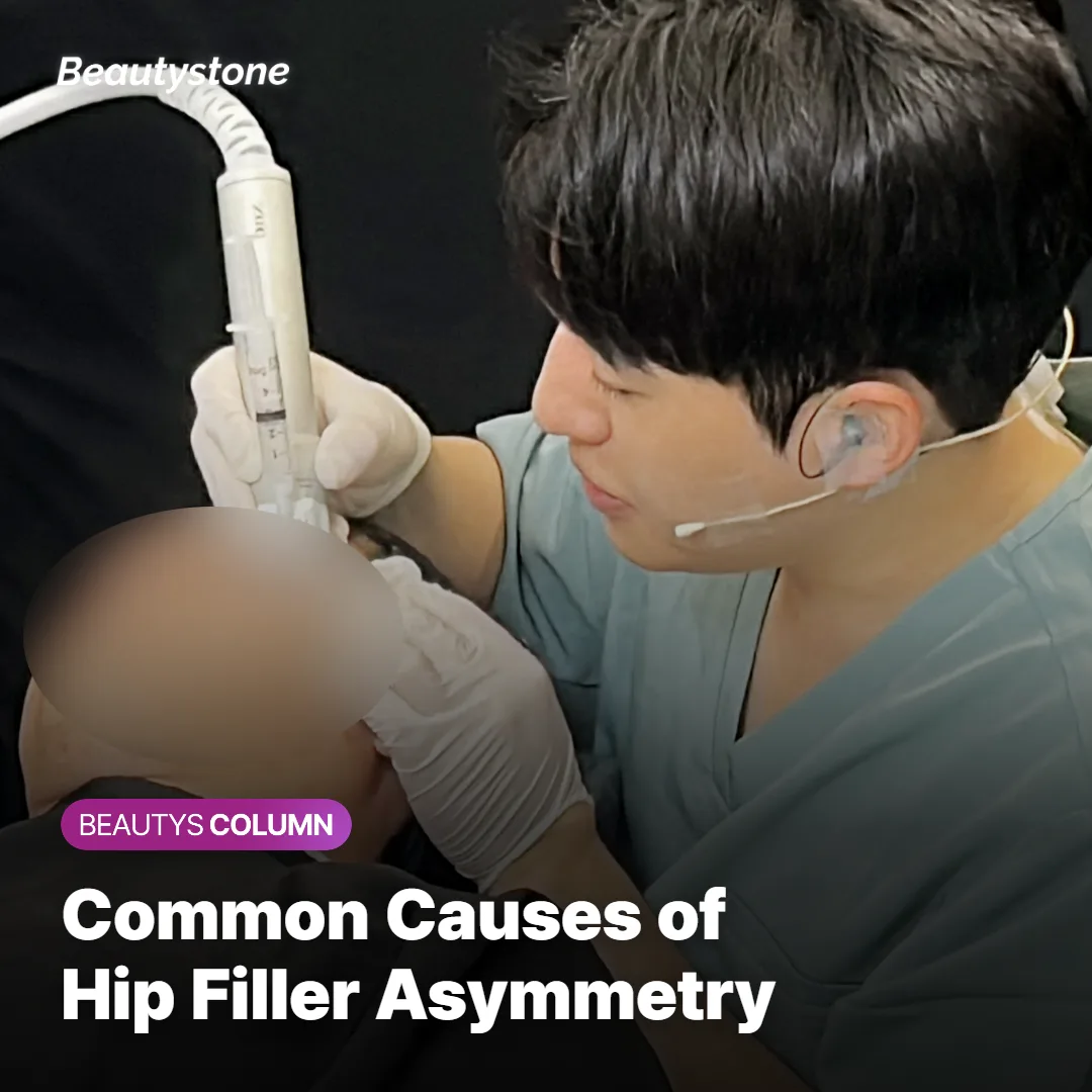 Diagram showing common causes of asymmetry after hip filler, including swelling and settling