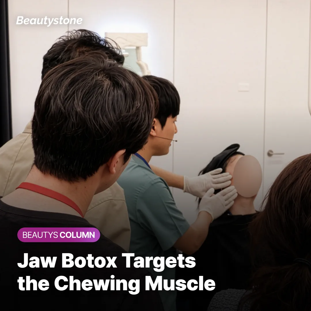 Diagram showing the masseter muscle at the jaw targeted by jaw Botox injections