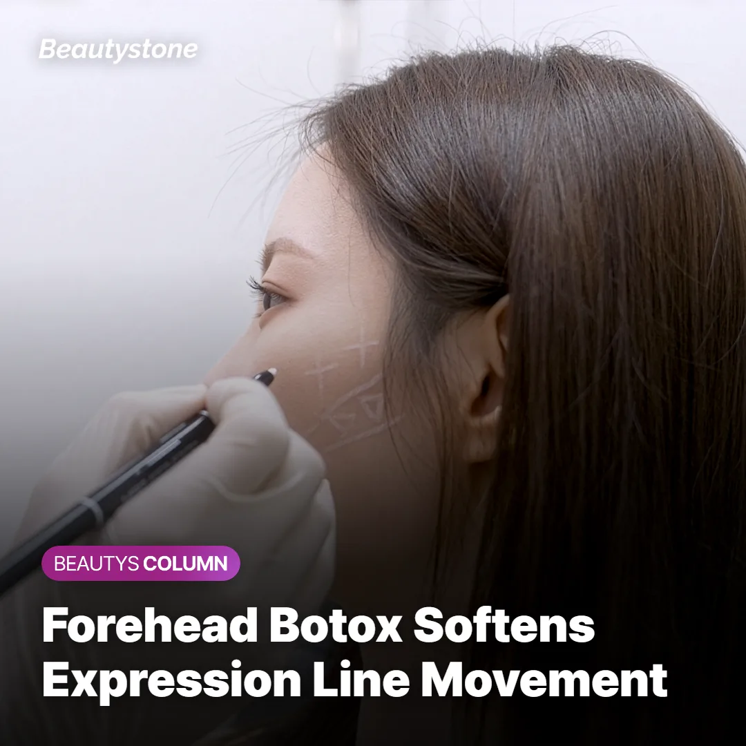 Diagram showing the forehead muscle targeted by forehead Botox injections
