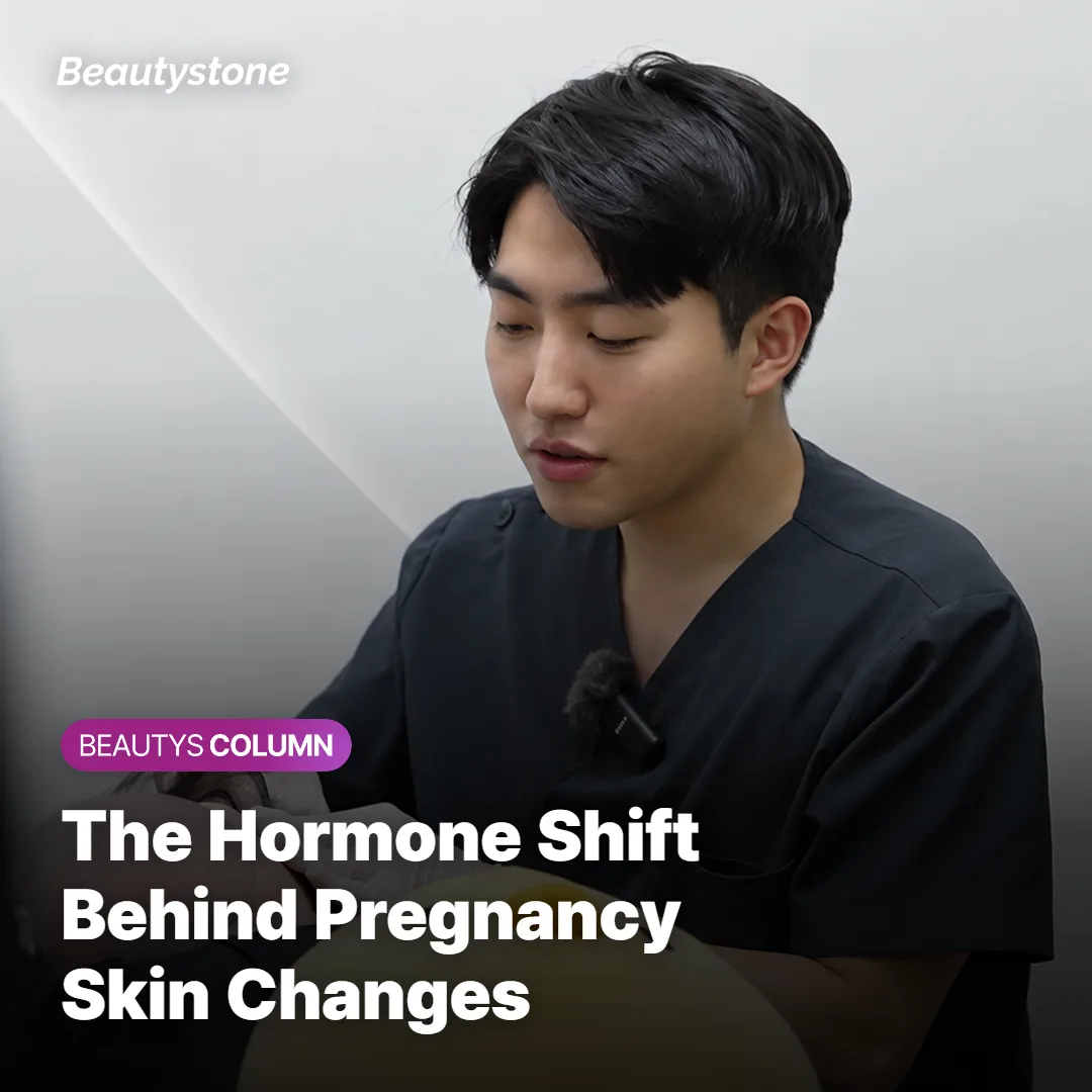 Illustration of hormonal changes affecting melanin production in skin during pregnancy