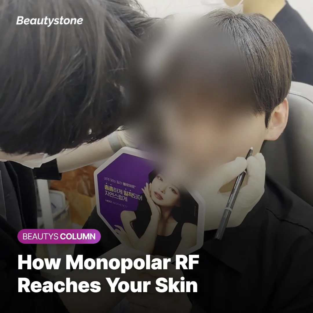 Diagram showing how monopolar radiofrequency energy heats the dermis to trigger collagen