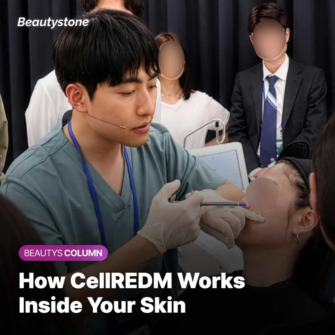 Illustration of a CellREDM injection delivering ingredients into the skin's dermis layer