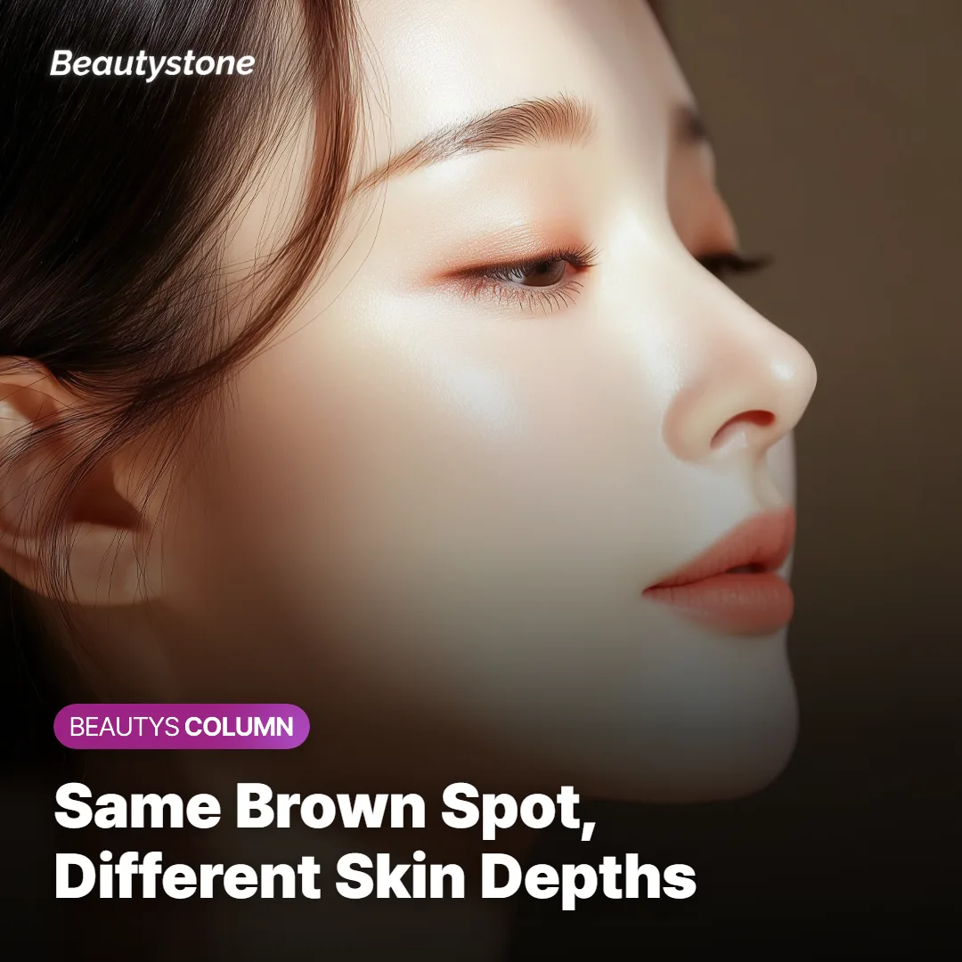 Diagram comparing shallow and deep pigment in the skin