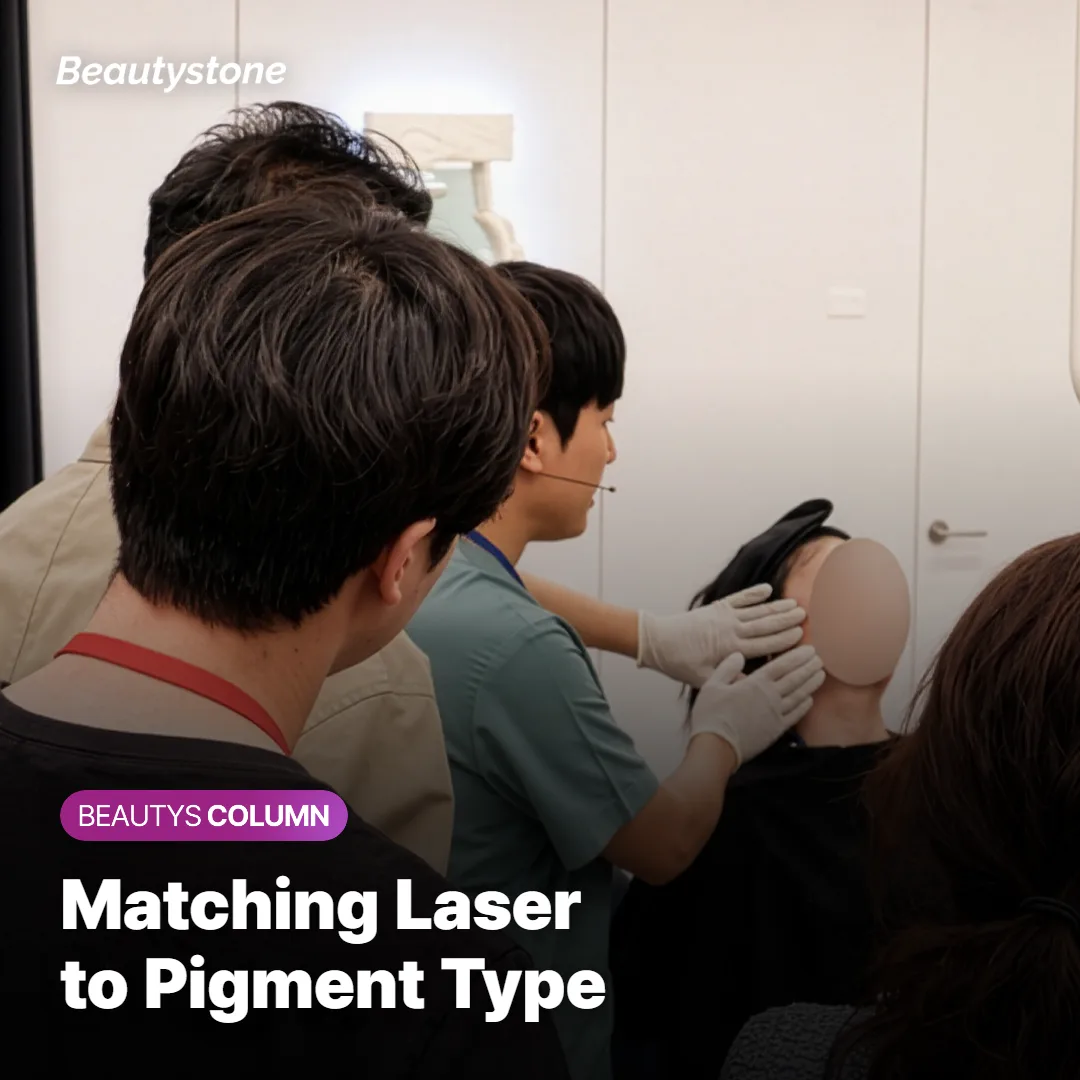 Comparison chart of laser options for age spots, melasma, and freckles