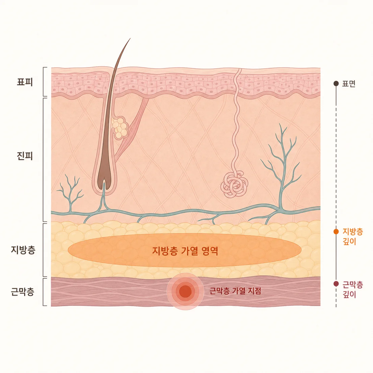 표피부터 근막층까지 — 열이 닿는 깊이 차이