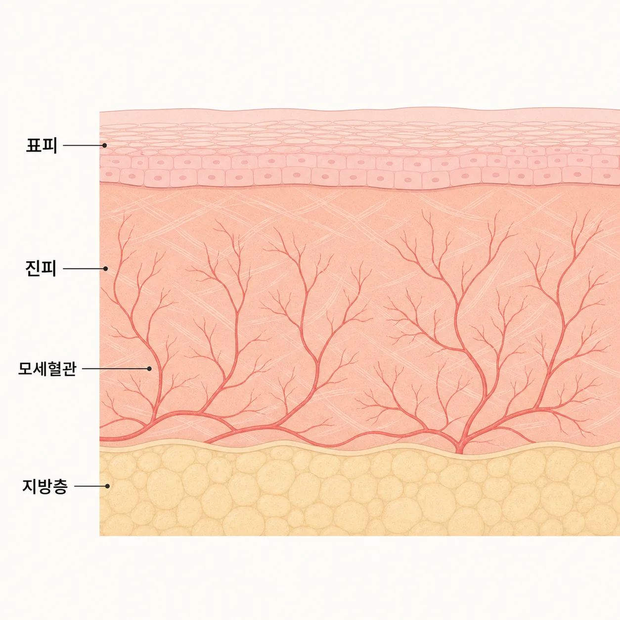 진피 속 모세혈관 — 붓기와 멍이 나타나는 자리