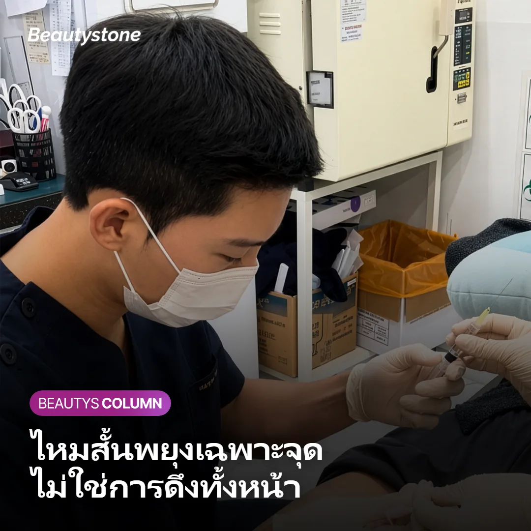 ภาพอธิบายว่าร้อยไหมสั้นพยุงเนื้อเยื่อและกระตุ้นคอลลาเจนอย่างไร