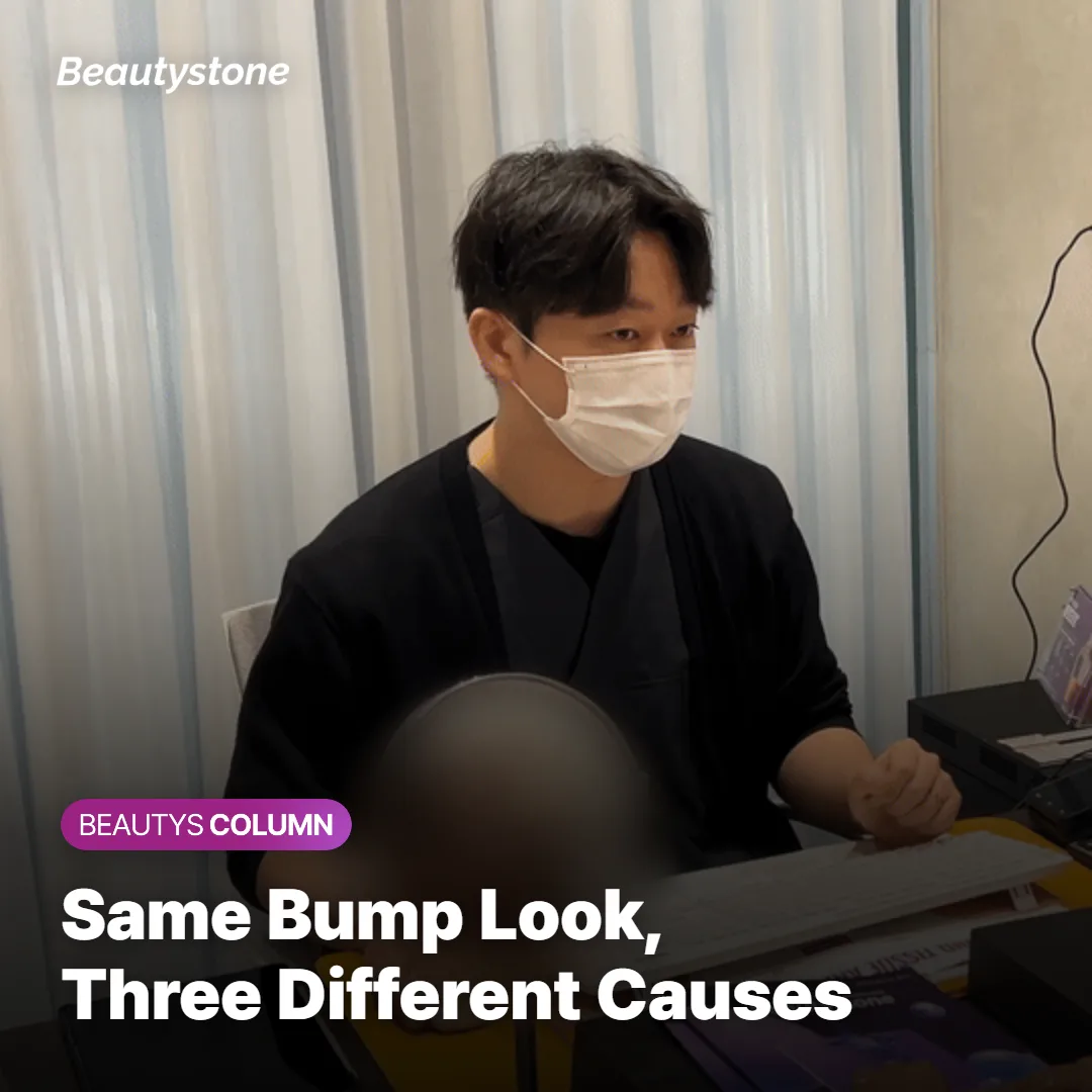 Illustration comparing syringoma, milia, and closed comedone bumps on skin