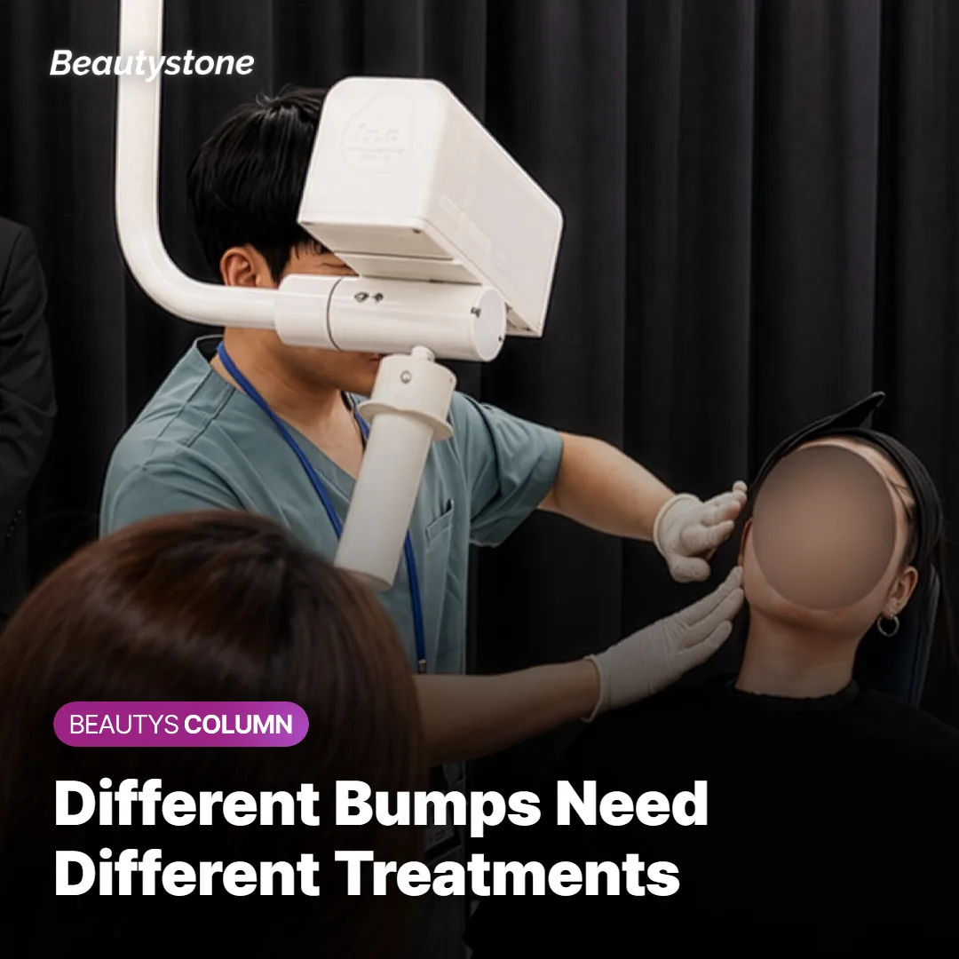 Dermatologist reviewing treatment options for facial skin bumps