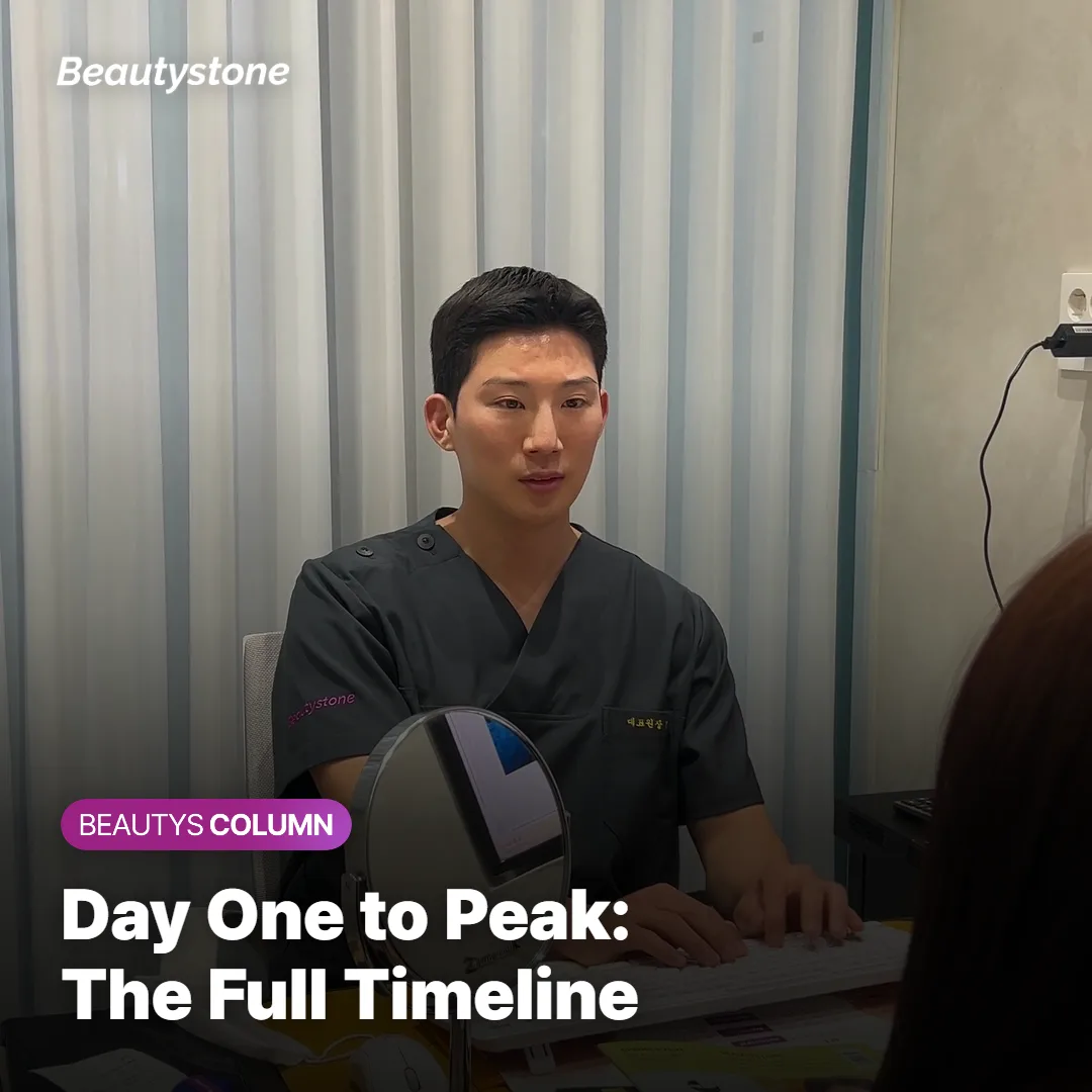 Timeline graphic showing Juvelook results from injection day through peak collagen buildup