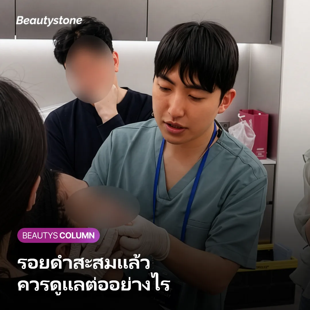ภาพแสดงการดูแลรอยดำสะสมจากหมวกกันน็อคด้วยการปรึกษาแพทย์