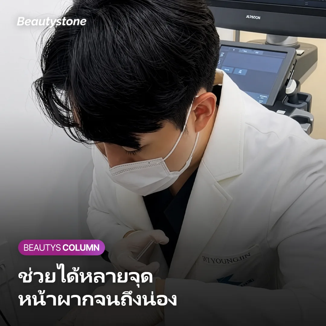 ภาพแสดงบริเวณที่นิยมฉีดโบท็อกซ์ เช่น หน้าผากและกราม
