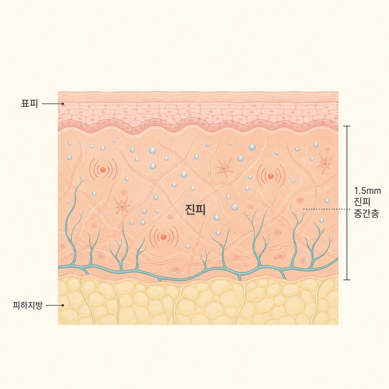 열 자극이 닿는 진피와 수분이 채워지는 상부 진피층