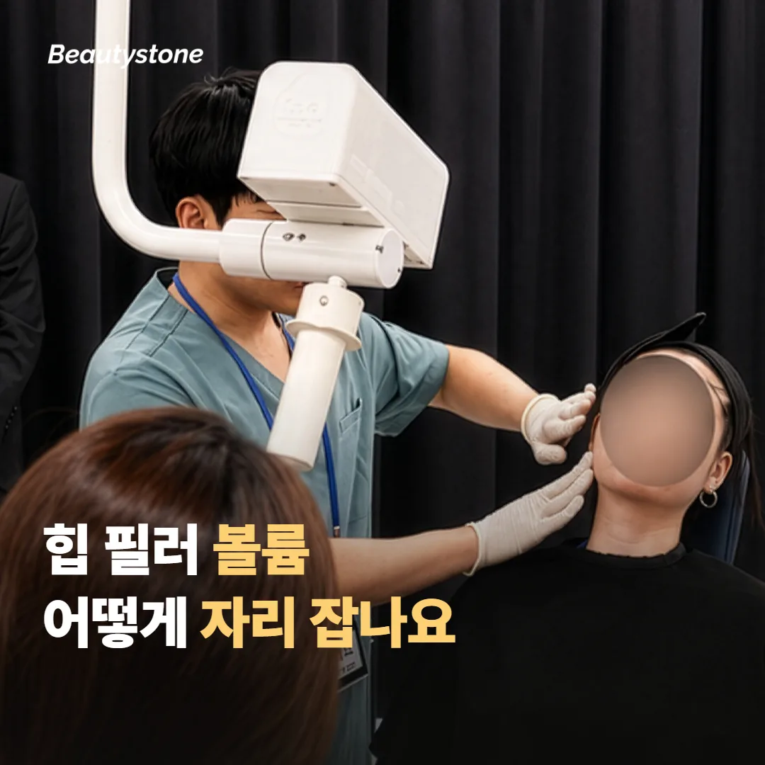 힙 필러 볼륨은 어떻게 자리 잡나요
