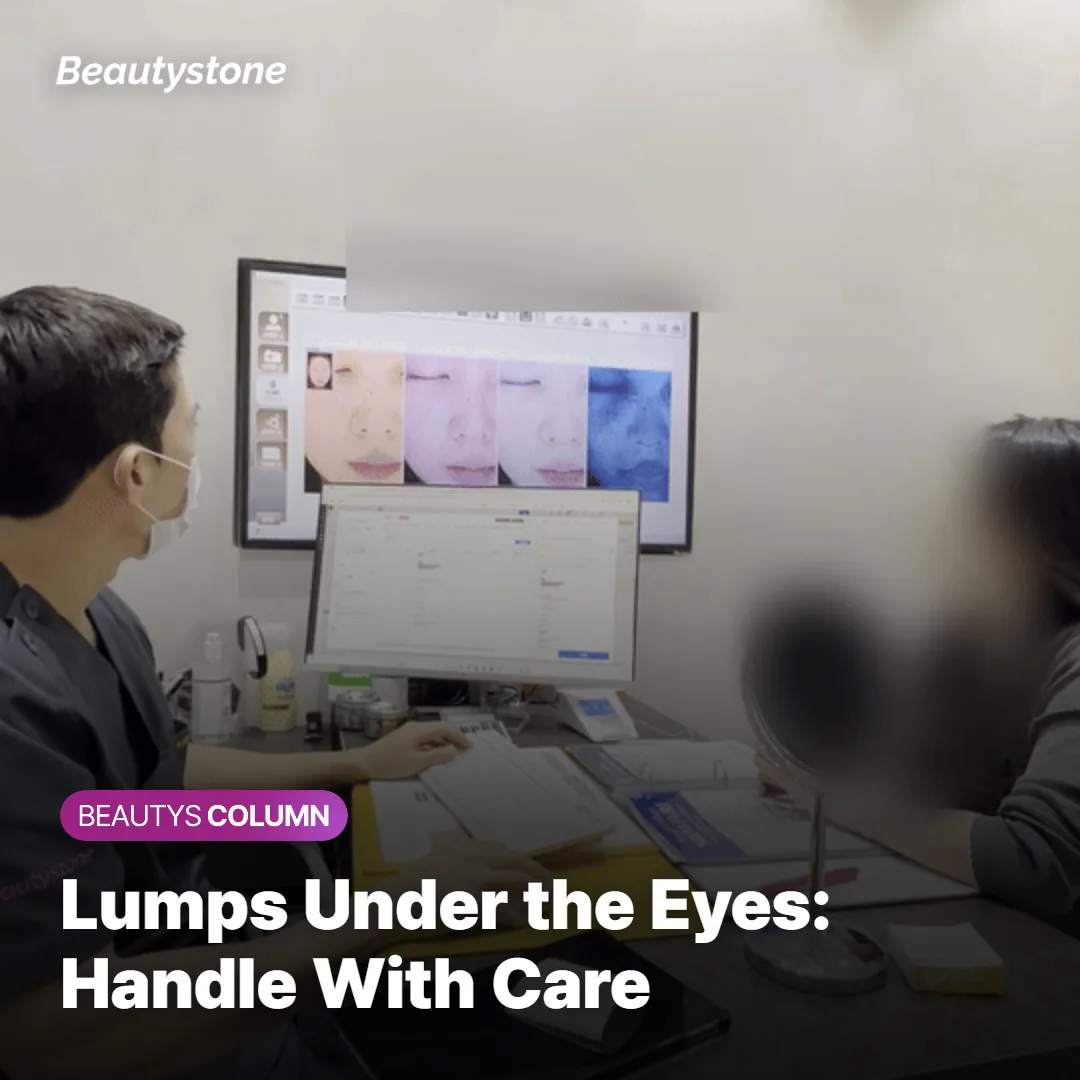Close-up of the thin under-eye skin where Sculptra lumps need extra care
