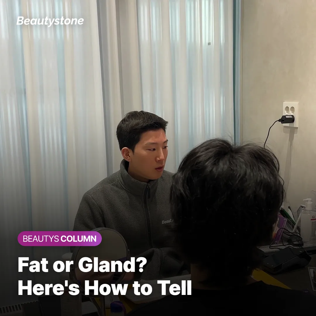 Side-by-side comparison of a fat-based double chin and a gland-based double chin