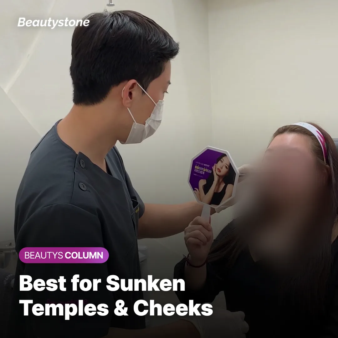 Illustration of ideal treatment areas for Juvelook Volume, including sunken temples and cheeks