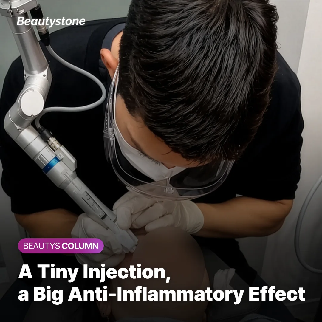 Diagram of a cortisone injection calming an inflamed acne lesion