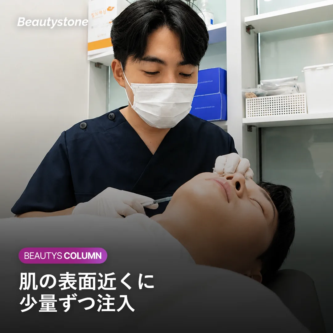 肌の表面近くに薬剤を注入する様子を示すイメージ