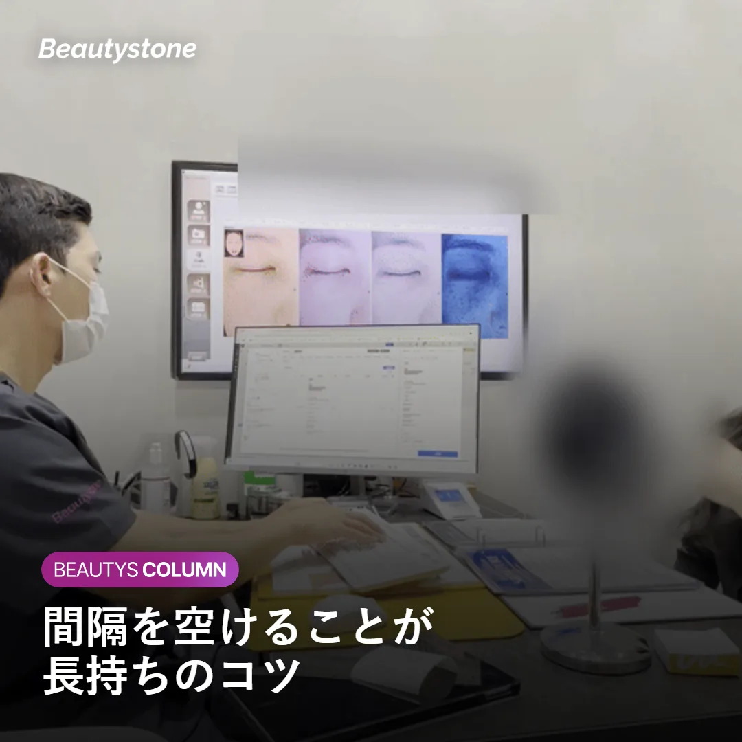 施術間隔をカレンダーで確認するイメージ