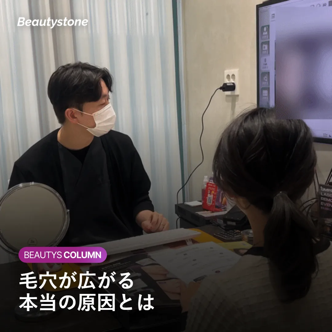 毛穴が広がって見える原因を示すイメージ