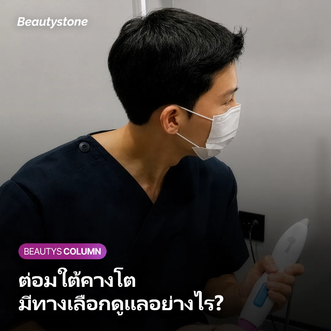 ภาพแสดงแนวทางดูแลต่อมใต้คางด้วยการฉีดโบท็อกซ์