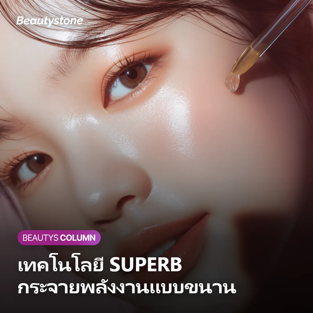ภาพแสดงเทคโนโลยี SUPERB ของ Sofwave ที่กระจายพลังงานแบบขนานที่ชั้นหนังแท้