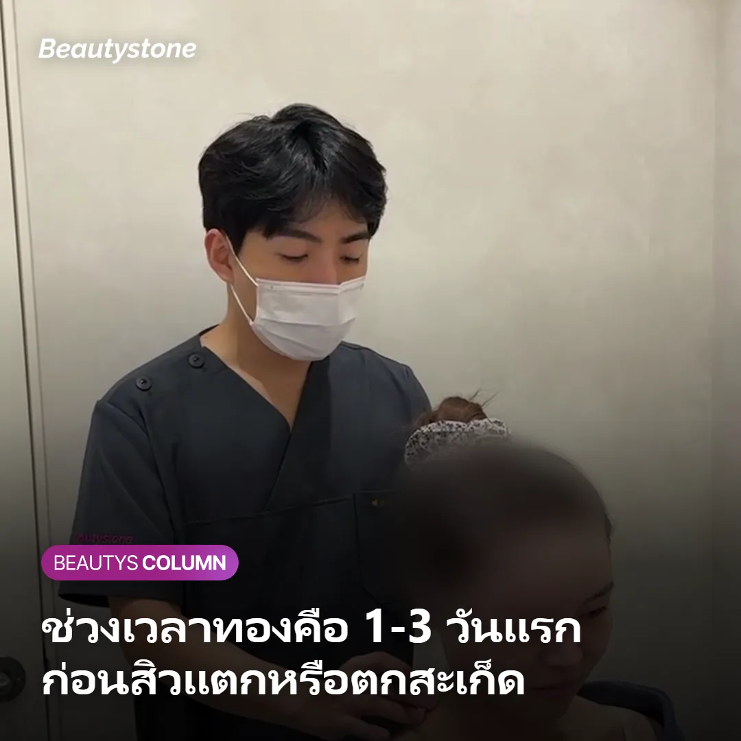 ภาพแสดงลักษณะสิวที่เหมาะกับการฉีดลดการอักเสบและช่วงเวลาทองในการฉีด