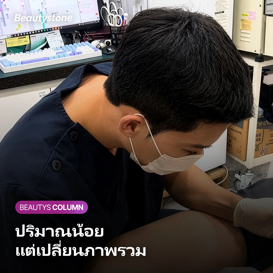 ภาพแสดงปริมาณฟิลเลอร์เล็กน้อยที่ใช้บริเวณใต้ริมฝีปาก