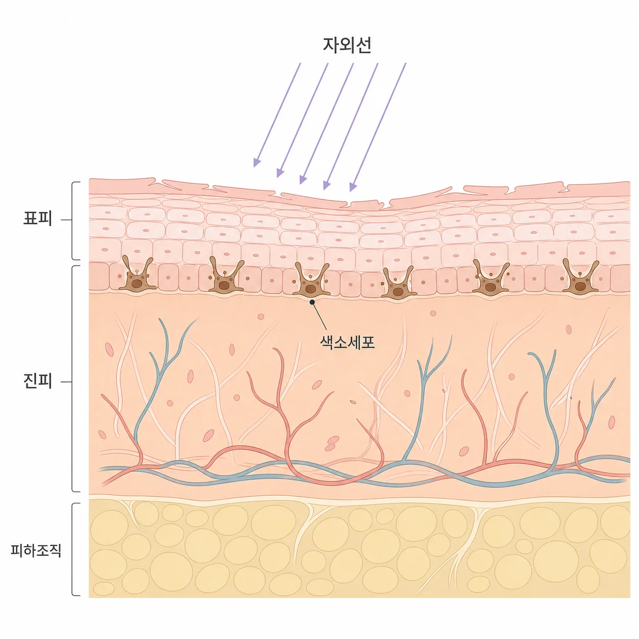 시술 후 잠시 약해진 장벽 위로 자외선이 더해지면 색소세포가 자극받기 쉬워요