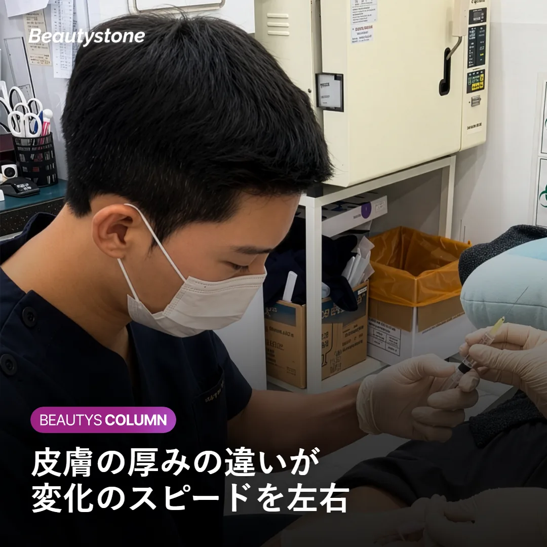 皮膚の厚みの違いを示すイメージ