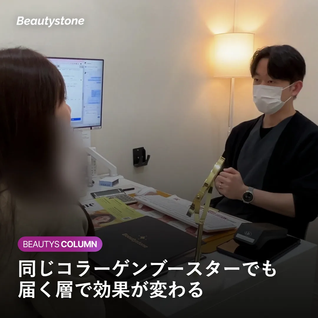 ジュベルックSB・ボリューム・リジュランの注入層の違いを示す図