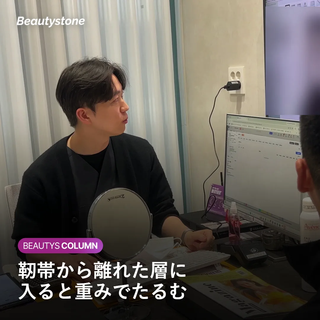 頬骨外側の皮下脂肪層に入ったフィラーが重みでたるむケースを示す図
