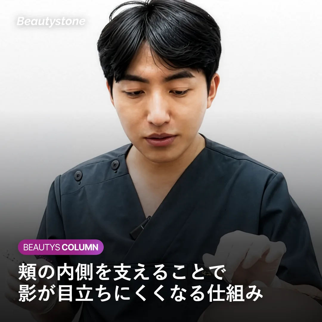 頬の内側の支持点を補いほうれい線の影が目立ちにくくなる仕組みを示す図