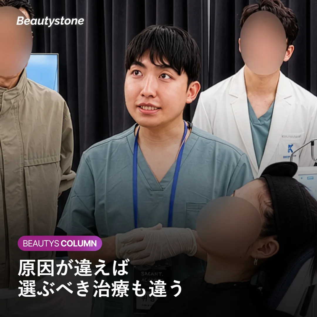 たるみの原因タイプ別に異なる治療アプローチを示す図