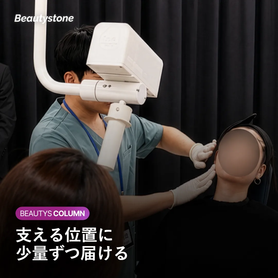 頬フィラーの注入ポイントと位置を示すイメージ