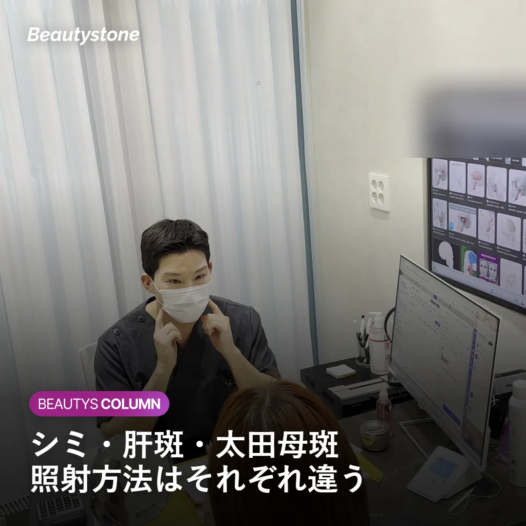 シミ・肝斑・太田母斑ごとの照射方法の違いを示す図