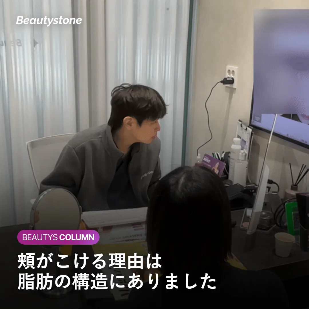 頬の脂肪区画が加齢で萎縮し中顔面が下がる仕組みを示す図