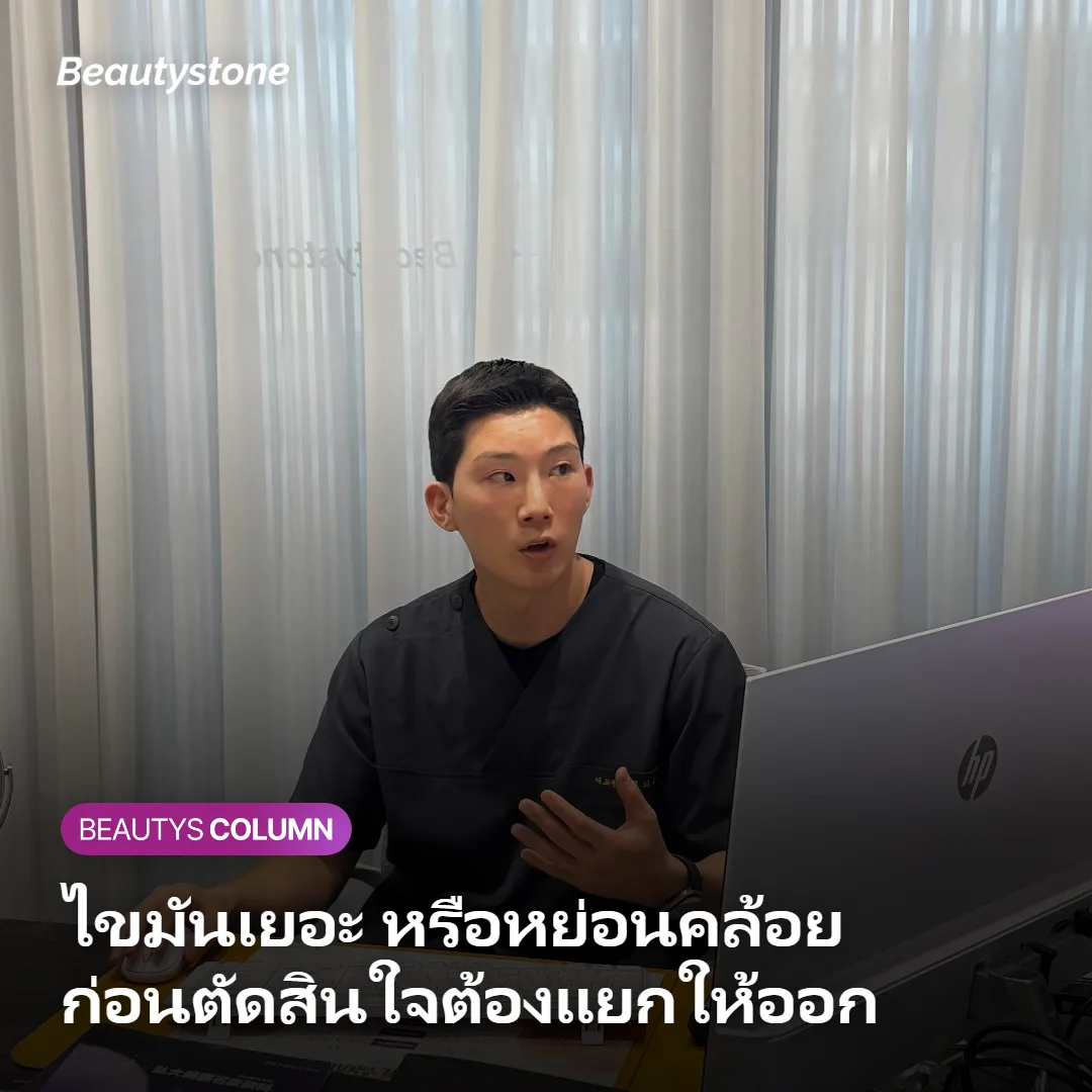ภาพเปรียบเทียบผู้ที่มีไขมันใต้คางเยอะกับผู้ที่มีปัญหาหย่อนคล้อยเป็นหลัก