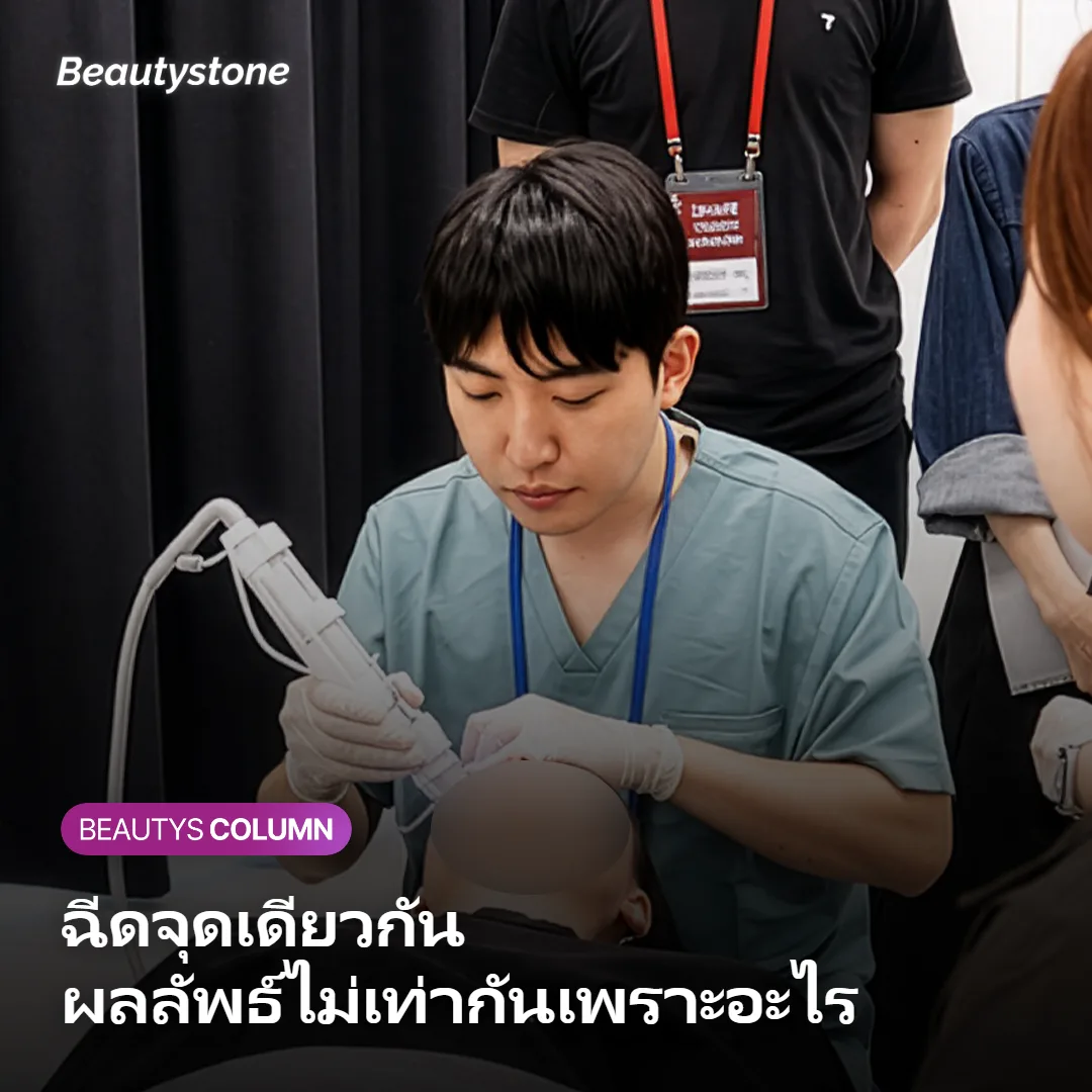ภาพแสดงความลึกของการฉีดคอลลาเจนบูสเตอร์ในชั้นผิว