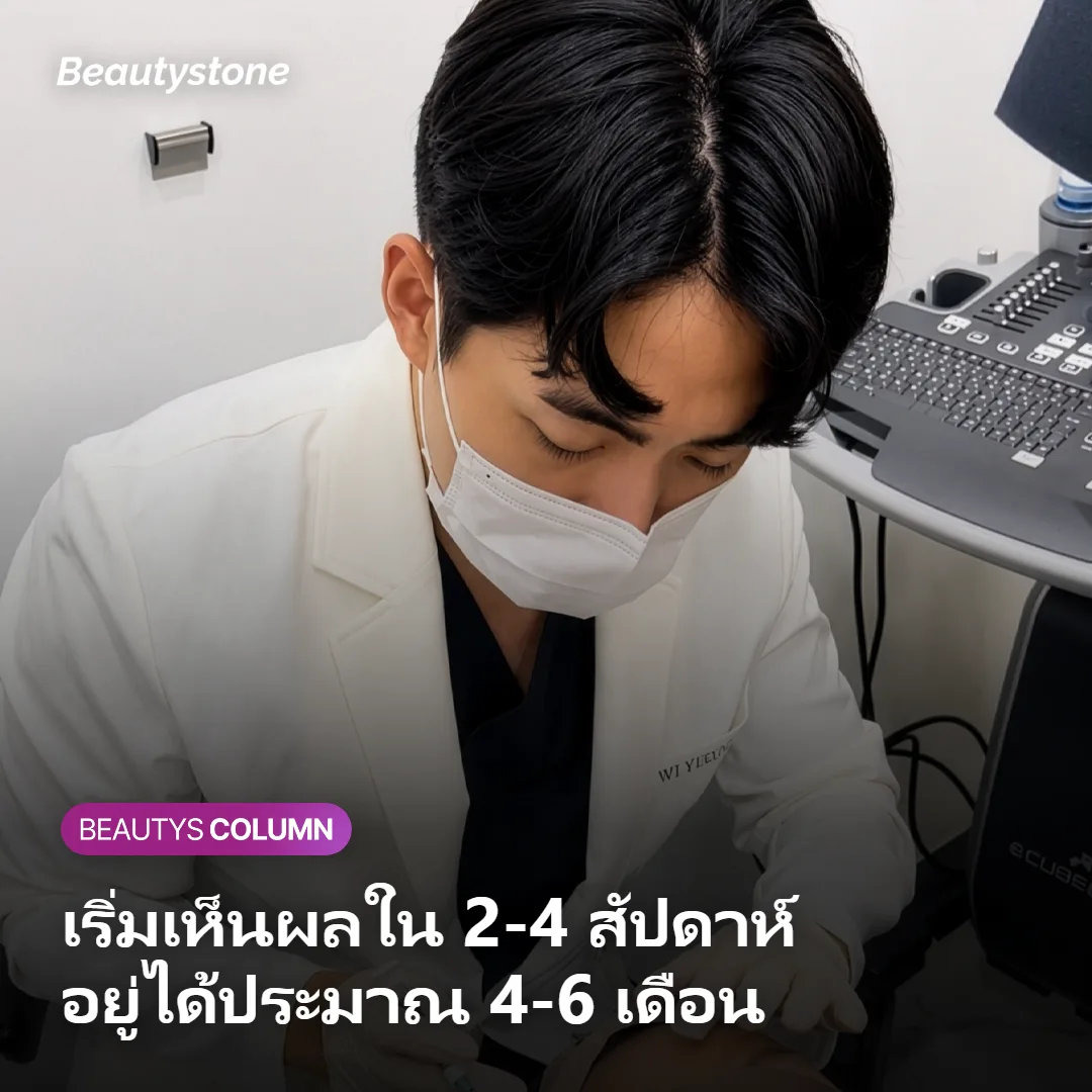 ภาพแสดงช่วงเวลาที่เริ่มเห็นผลและระยะเวลาที่ผลของโบท็อกซ์กรามอยู่ได้