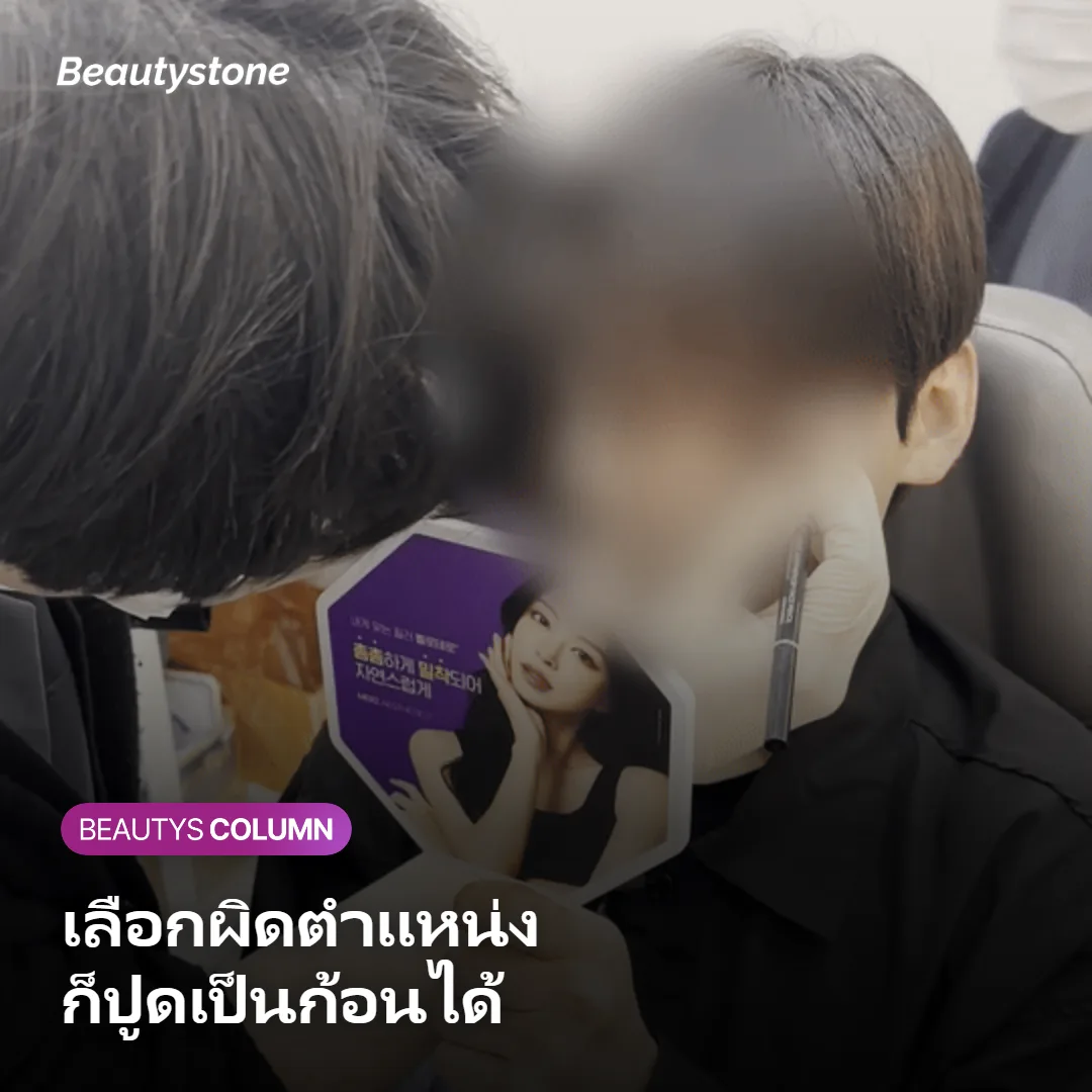 ภาพแสดงตัวอย่างตำแหน่งที่เหมาะกับฟิลเลอร์แต่ละชนิดบนใบหน้า