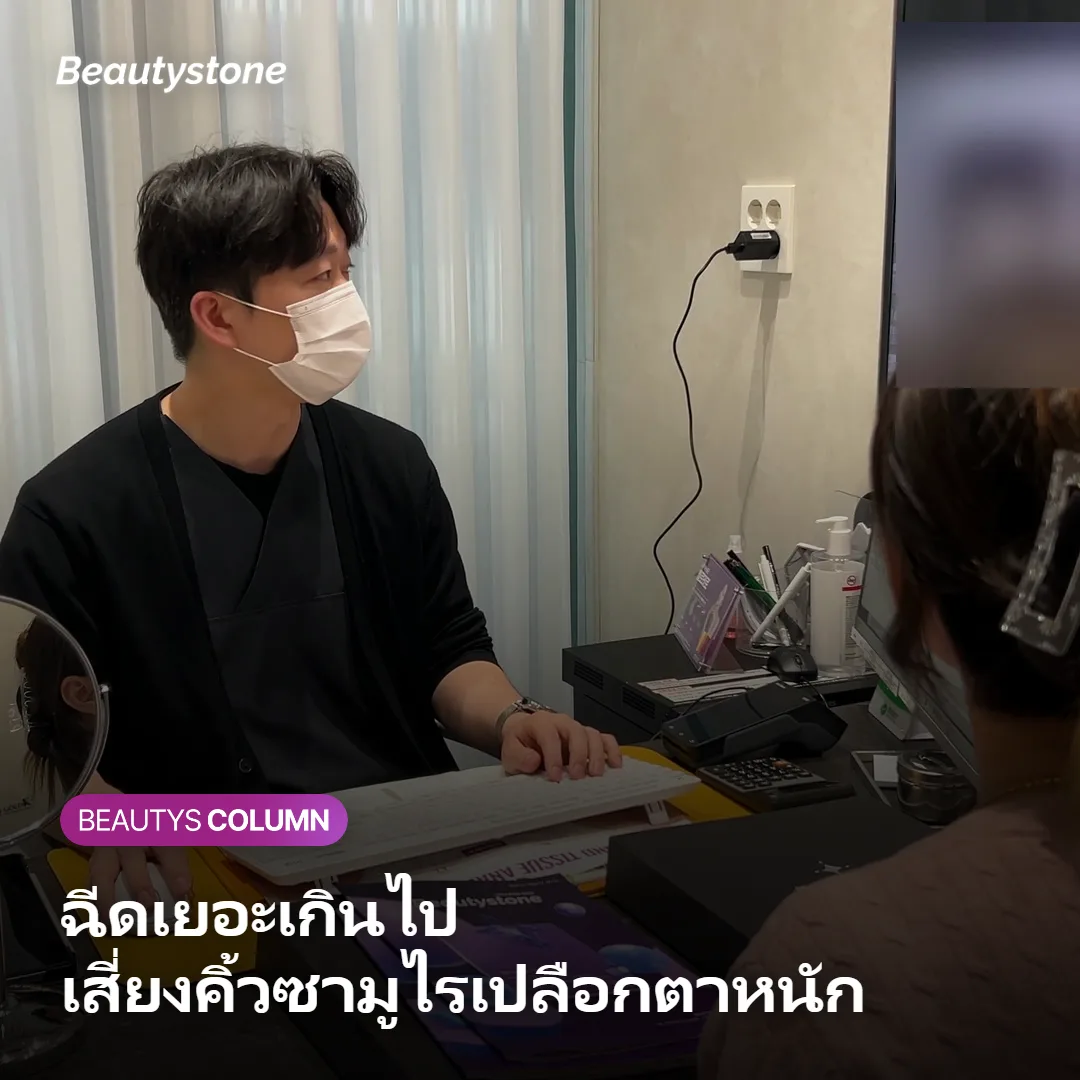 ภาพแสดงความเสี่ยงเปลือกตาหนักและคิ้วซามูไรจากการฉีดโบท็อกซ์หน้าผากมากเกินไป